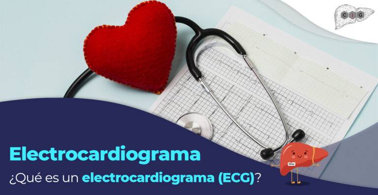 electrocardiograma