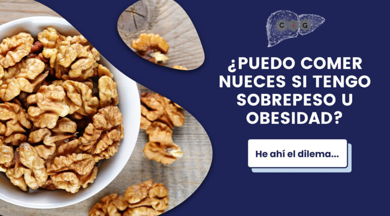 nueces y almendras